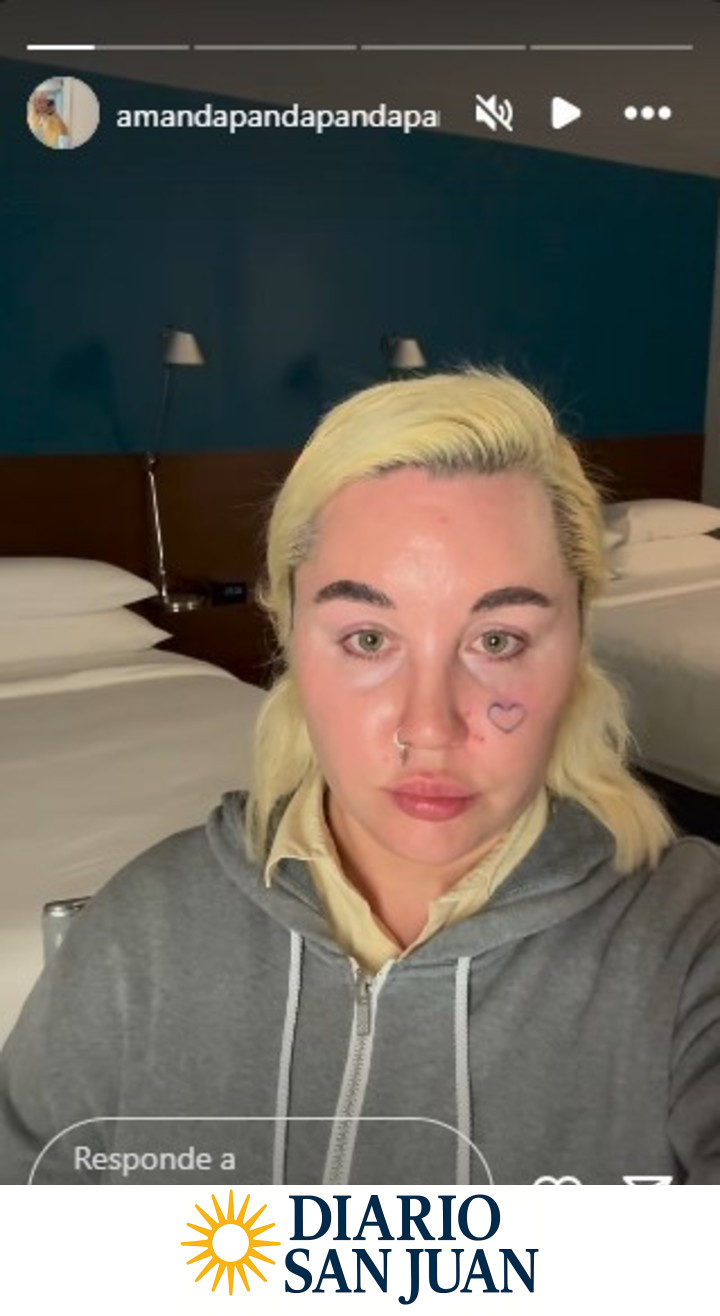 Amanda Bynes fue internada tras un brote psicótico en 2022. Foto: Instagram.